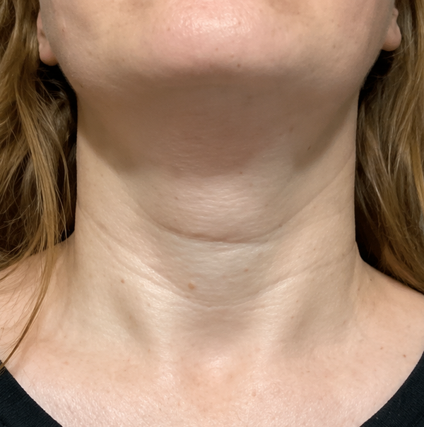 Week 1: Hydration & Smoothness